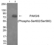 AP55829PU-S - PAK6