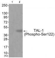 AP55831PU-S - TAL1