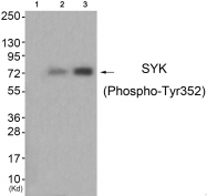 AP55842PU-S - SYK