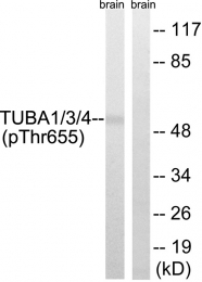 AP55843PU-S - TUBA1/3/4