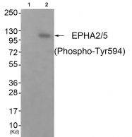 AP55847PU-S - EPHA2 / EPHA5