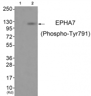 AP55849PU-S - EPHA7