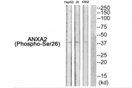 AP55852PU-S - Annexin A2 / ANXA2