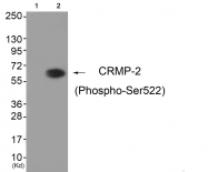 AP55854PU-N - DPYSL2 / CRMP2