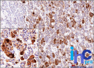 AM50155PU-S - Adrenocorticotropic Hormone (ACTH)