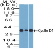 AM50162PU-S - Cyclin D1