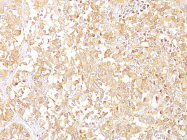 AM50168PU-S - Melanoma gp100