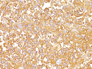 AM50168PU-S - Melanoma gp100