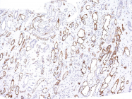 AM50179PU-S - Complement C4d