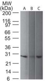 AM50184PU-N - UCHL1 / PGP9.5