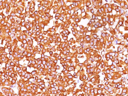 AM50186PU-S - Vimentin
