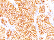 AM50188PU-S - Carbonic anhydrase 9