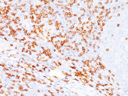 AM50192PU-S - CD8