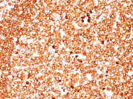 AM50196PU-S - CD79a