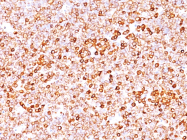 AM50197PU-S - CD79a