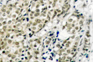 AP06010PU-N - Androgen receptor