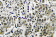 AP06011PU-N - Androgen receptor