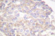 AP06012PU-N - Annexin A6 / ANXA6