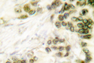 AP06013PU-N - TFAP2A / AP-2 alpha