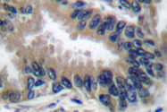 AP06014PU-N - APAF1