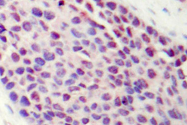 AP06019PU-N - ATF2