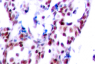 AP06022PU-N - ATF2