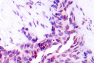 AP06023PU-N - ATF2