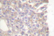 AP06032PU-N - Bcl-2-like 11