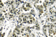 AP06033PU-N - BRCA1 / RNF53