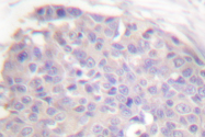 AP06035PU-N - CARD6