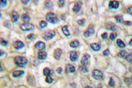 AP06039PU-N - Junction plakoglobin