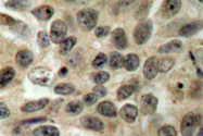AP06044PU-N - CDC25C