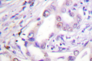 AP06045PU-N - CDC6