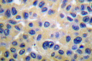 AP06068PU-N - Collagen type II alpha 1 chain