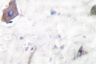 AP06072PU-N - Cyclooxygenase 1