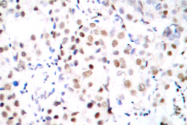 AP06073PU-N - CREB1