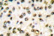 AP06074PU-N - CREB-binding protein