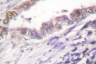 AP06079PU-N - Cyclin A2