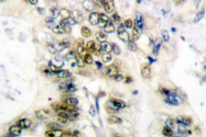 AP06082PU-N - Cyclin E1