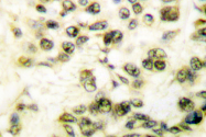 AP06088PU-N - DNA-PKcs / PRKDC / XRCC7