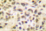 AP06089PU-N - TFDP1