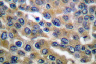 AP06094PU-N - EEF2