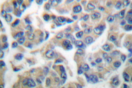 AP06095PU-N - EEF-2 kinase