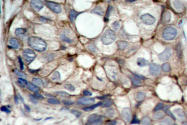 AP06096PU-N - EGFR / ERBB1