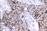 AP06097PU-N - EGFR / ERBB1