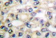 AP06098PU-N - EGFR / ERBB1