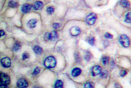 AP06099PU-N - EGFR / ERBB1
