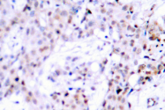 AP06109PU-N - Estrogen receptor alpha