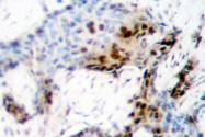 AP06110PU-N - Estrogen receptor alpha