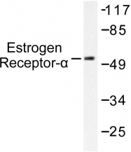 AP06111PU-N - Estrogen receptor alpha